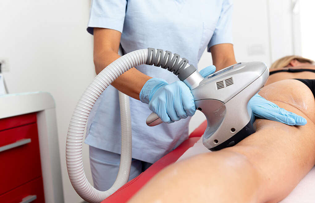 Addio Cellulite: Scopri il Potenziale della Velashape