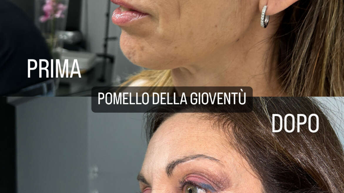 Pomello della gioventù